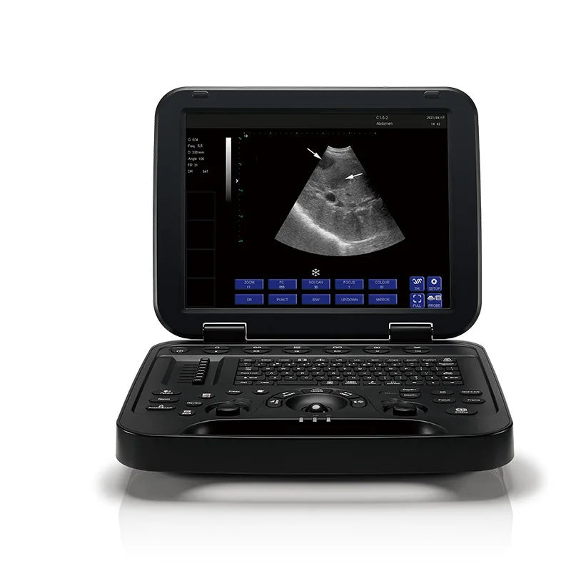 How to Choose the Right Veterinary Portable Ultrasound for Pets -Cardiology: Buying Criteria