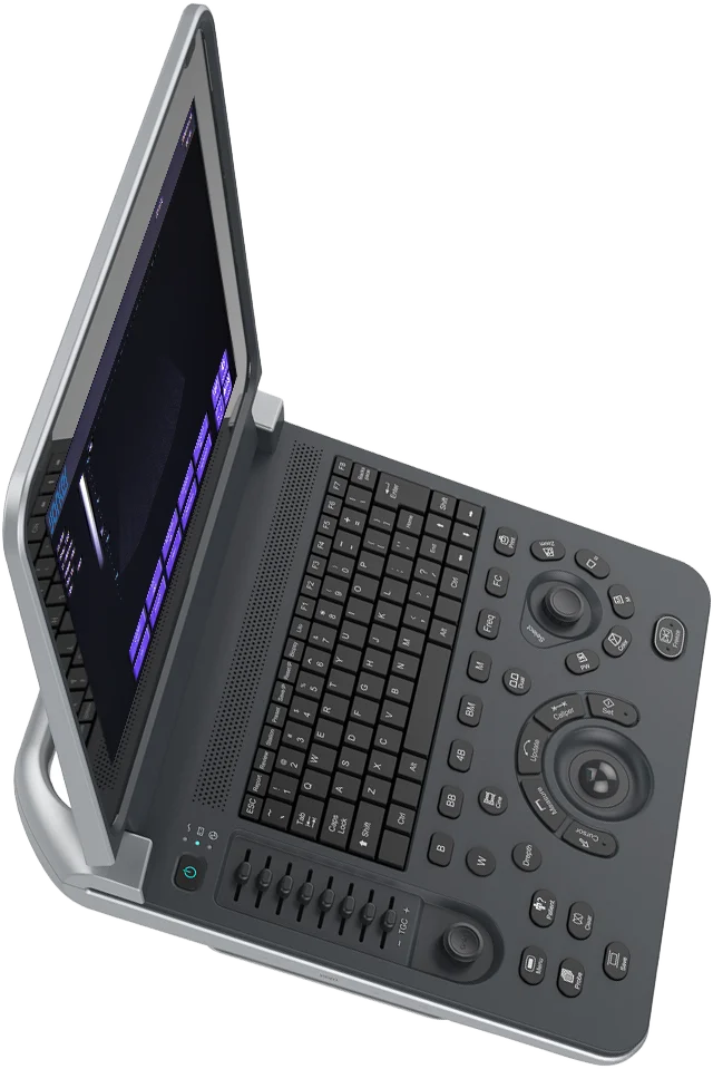 Portable Veterinary Ultrasound Machine for Pets & Animals - Cardiology, urology, gynecology, obstetrics, small organs, vascular