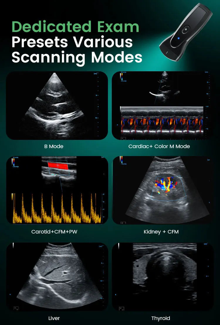 Ecógrafo Doppler Color Inalámbrico Portátil Veterinario, imágenes HD, resistente al agua, Genérico, Abdomen, Obstetricia, Urología, Musculoesquelético, Cardiología