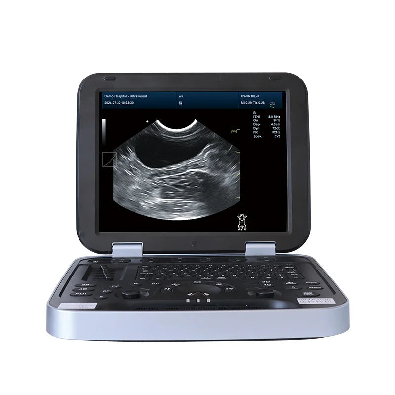 Ecógrafo Doppler Color Veterinario para Mascotas - Escáner Portátil HD con Sonda Múltiple y Batería de Larga Duración