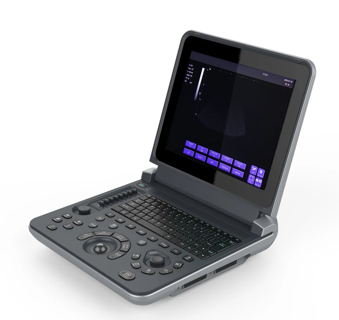 Portable Veterinary Ultrasound Machine for Pets & Animals - Cardiology, urology, gynecology, obstetrics, small organs, vascular