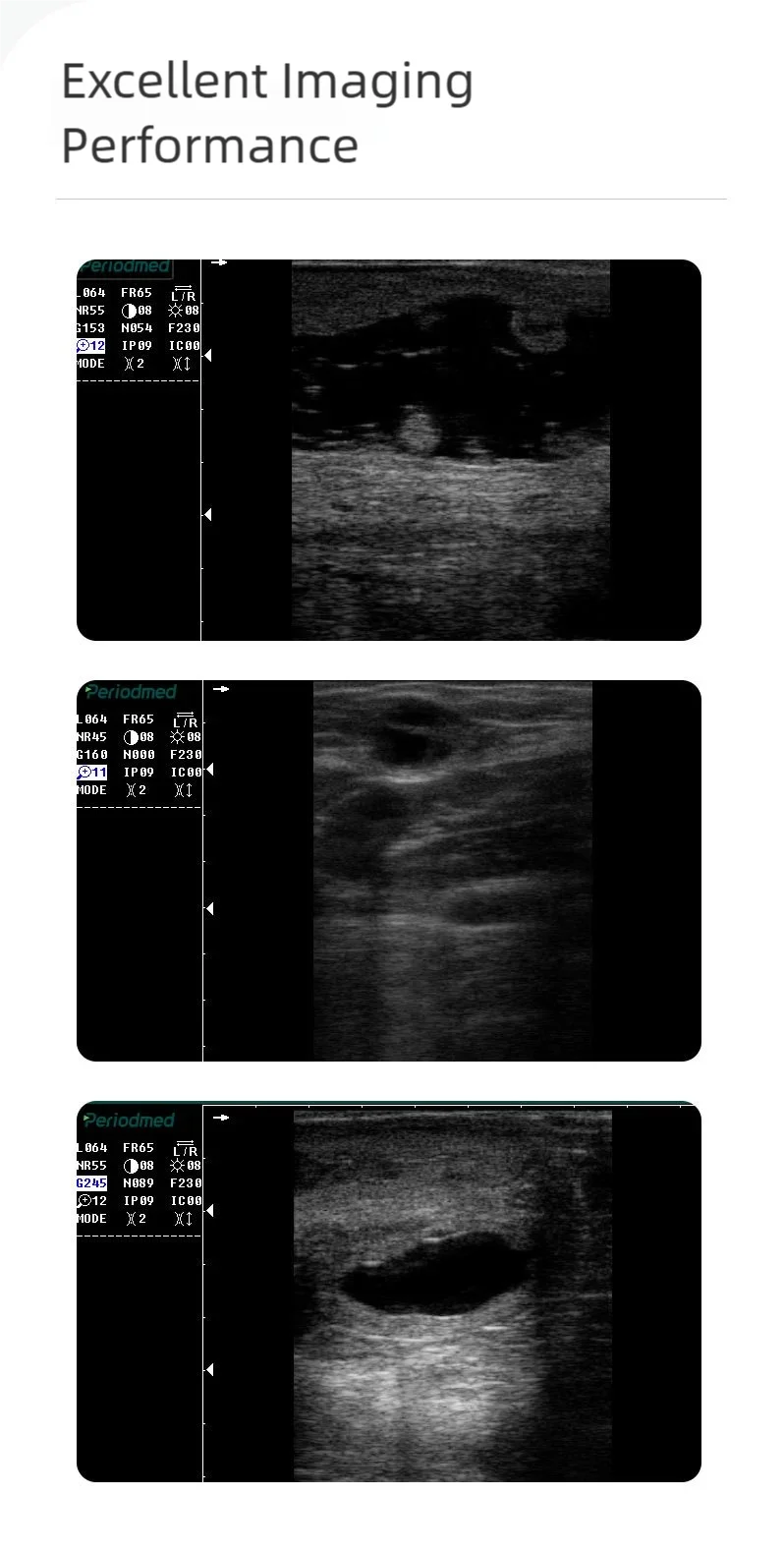 ALL animal veterinary Ultrasound, 3.5/5.0/6.5Hz, waterproof ,Veterinary Equipment, animal pregnancy test