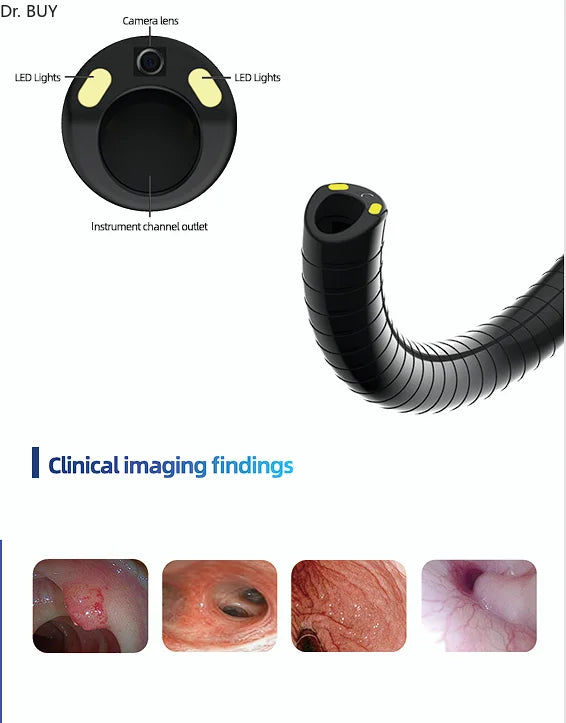 Reusable Digital Flexible Bronchoscopy, clinical Reusable endoscope, 2.8~5.8mm diameter /600mm working length