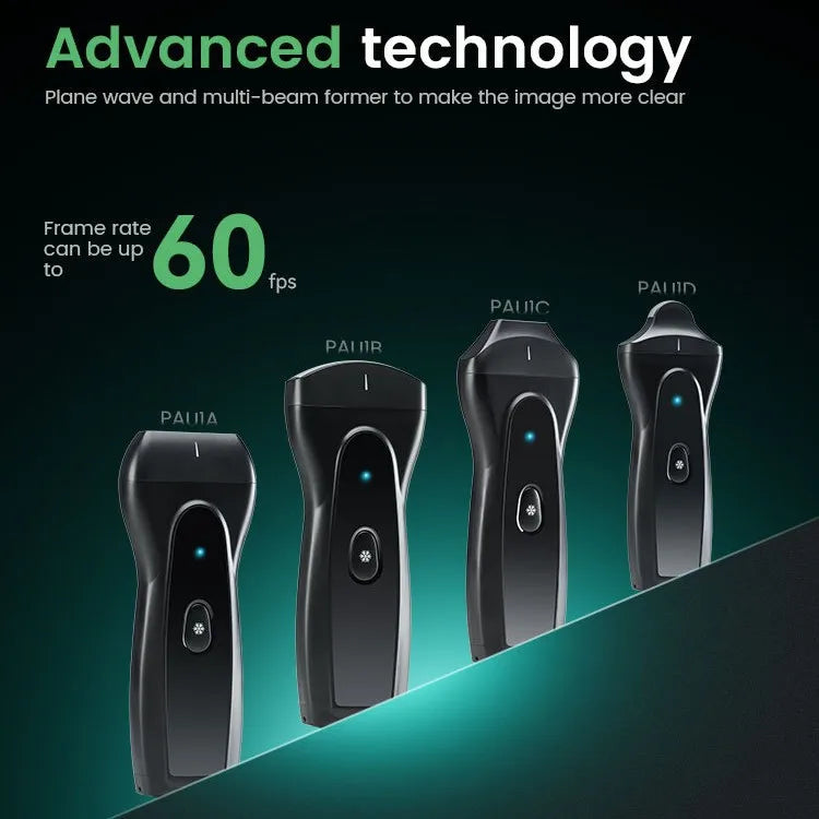 Ecógrafo Doppler Color Inalámbrico Portátil Veterinario, imágenes HD, resistente al agua, Genérico, Abdomen, Obstetricia, Urología, Musculoesquelético, Cardiología