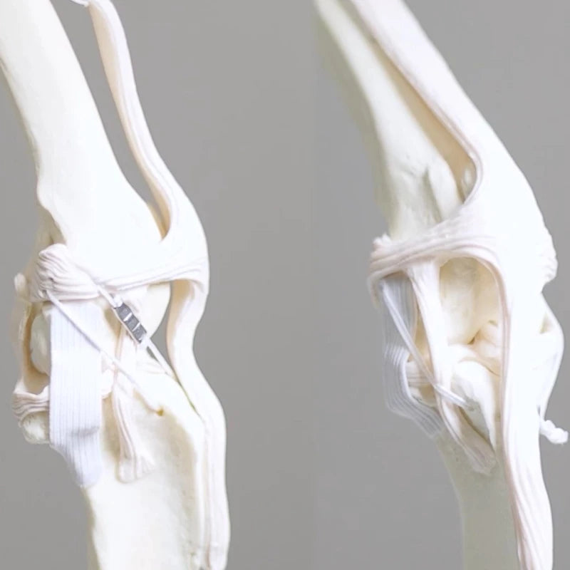 Orthopedic Dog Artificial Ligament System with Breakable Anchors for Hip Dislocation Repair